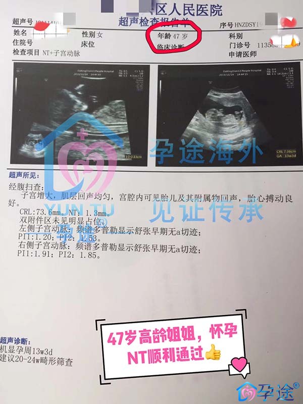 47岁泰国试管婴儿好孕
